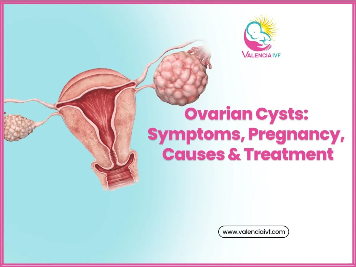 Ovarian Cysts: Symptoms, Pregnancy, Causes & Treatment