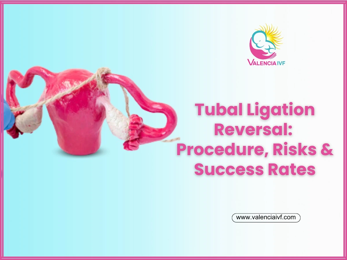 Tubal Ligation Reversal: Procedure, Risks & Success Rates - Valencia IVF